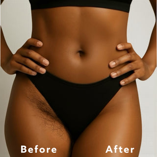 Hair Removal Mask Charcoal and Turmeric