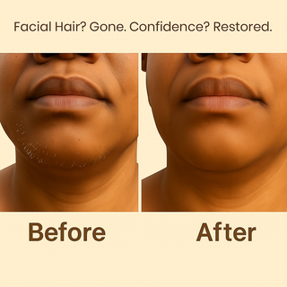 Facial Hair Removal Mask