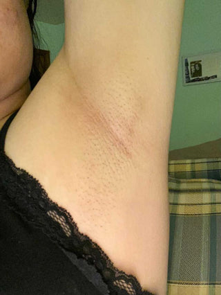 After brazilian wax!